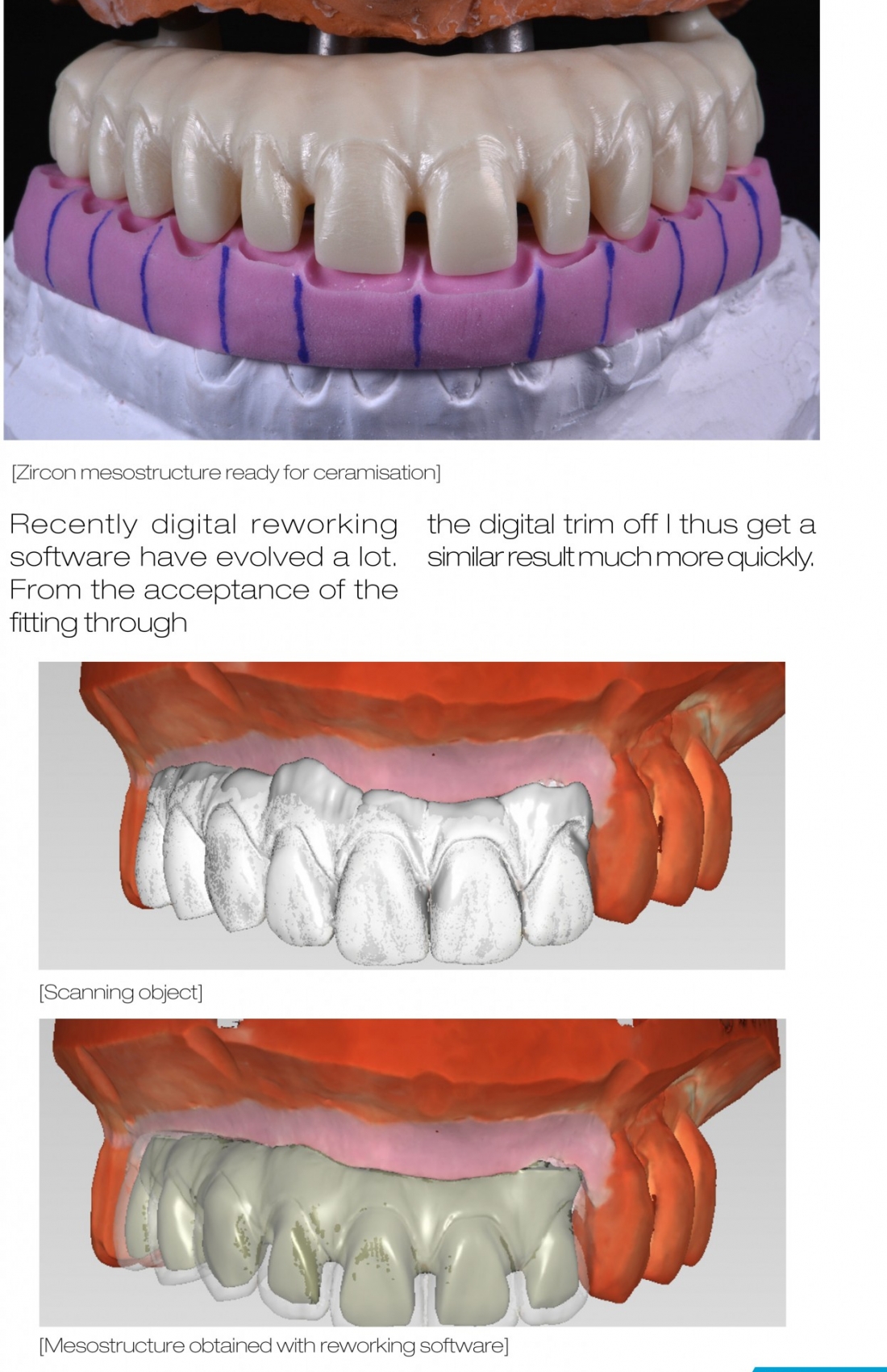 FULL ARCH IMPLANT REHABILITATION | Laboratorio Odonto Protesico